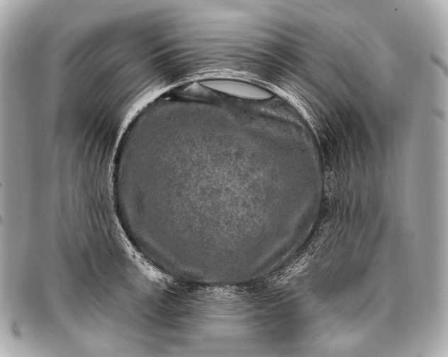 X0000096450995200802071807