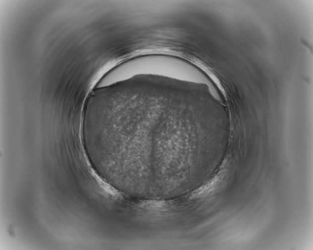 X0000096451245200802071804