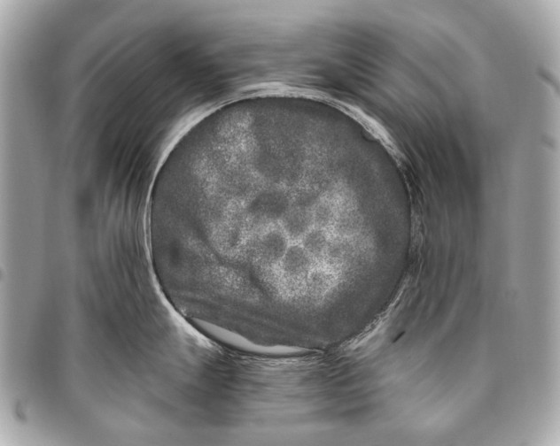 X0000096451247200802071804