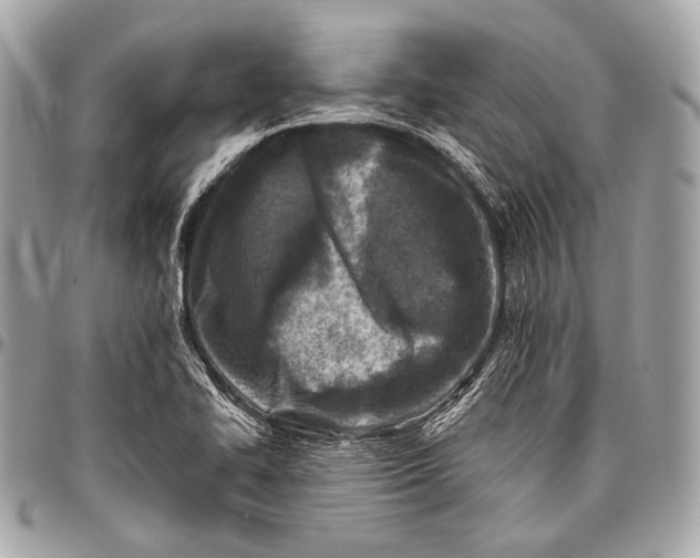 X0000096451414200802071801