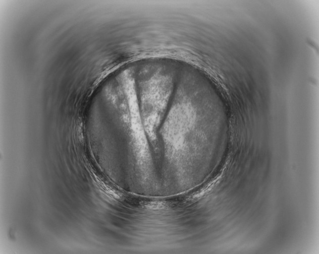 X0000096451497200802071759