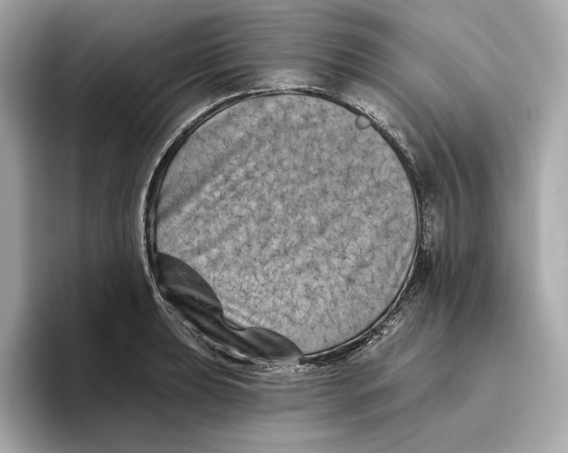 X0000096451039200802141508