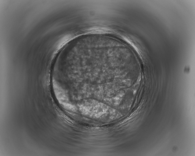 X0000096451459200802211223