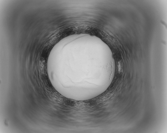 X0000096461059200802071829