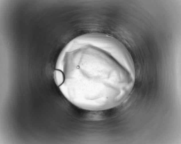 X0000096460179200802141539