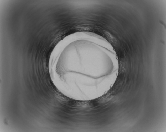 X0000096460377200802211132