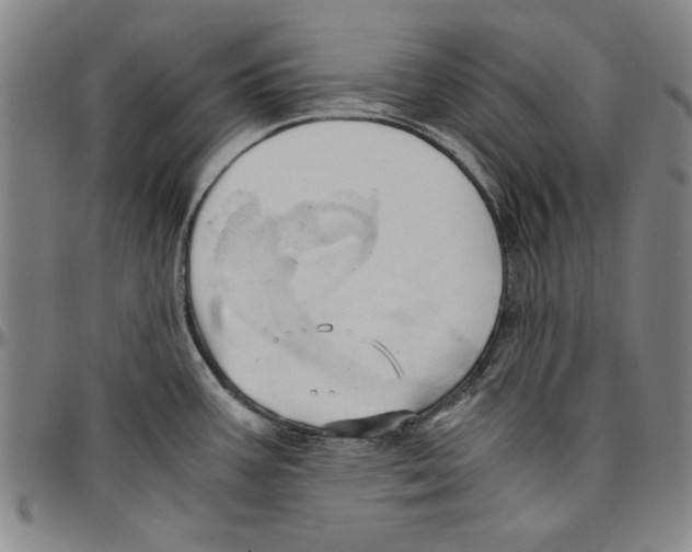 X0000096461387200802211115