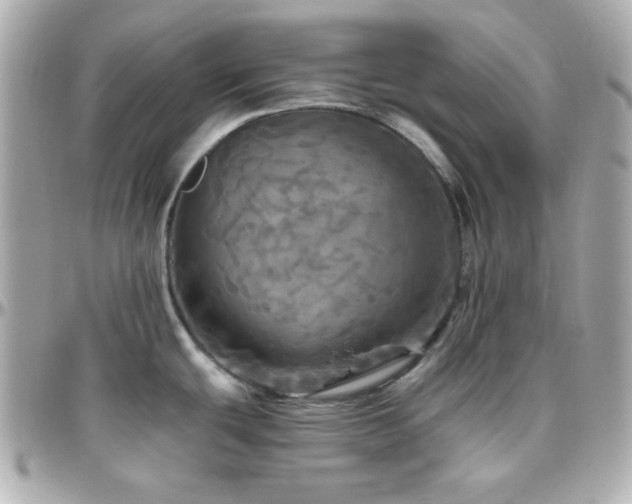 X0000096471439200801241419