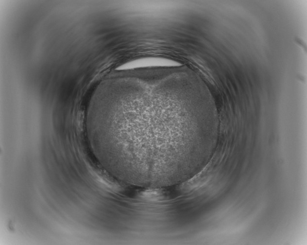 X0000096470171200802071904