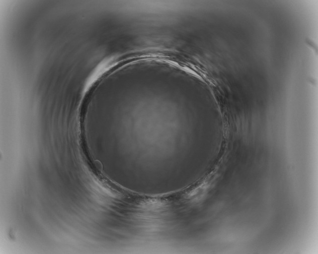 X0000096470198200802071904