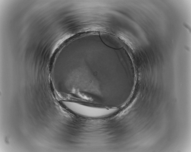 X0000096471117200802071850