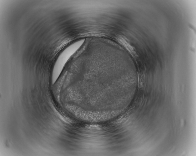 X0000096470157200802141706