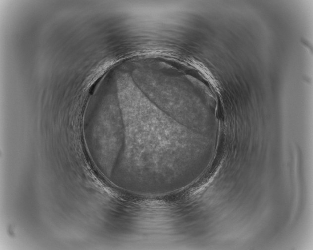 X0000096470577200802141700