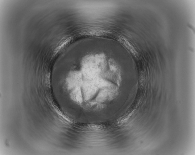 X0000096470585200802141700