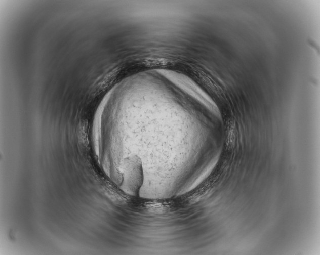 X0000096470616200802141700