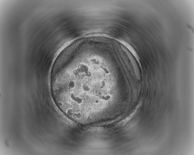 X0000096470957200802141655