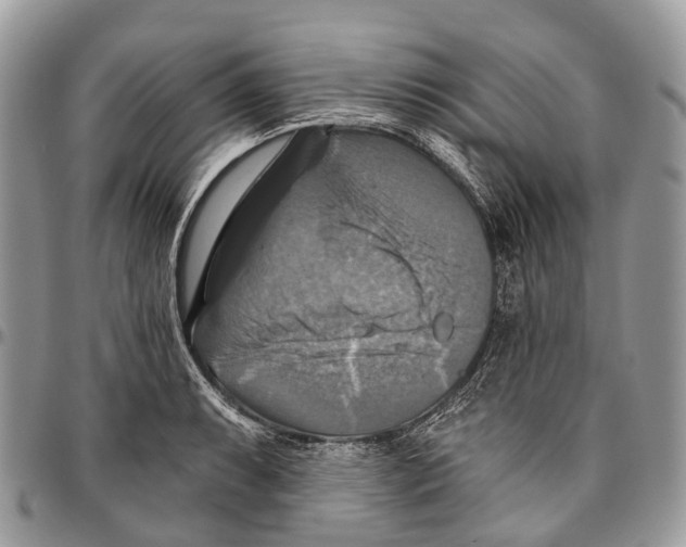 X0000096471087200802141652