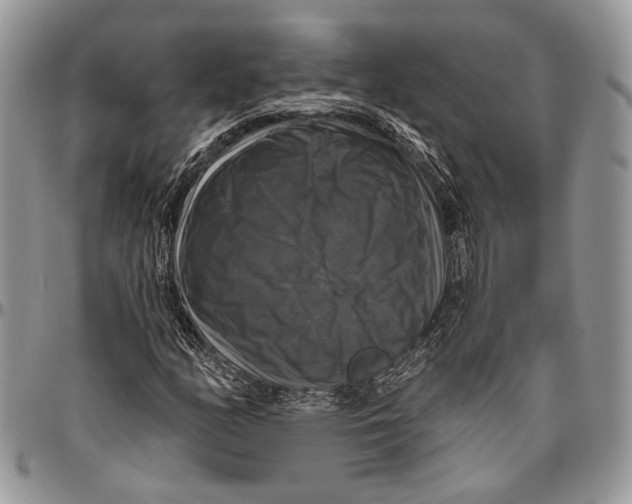 X0000096471158200802141651