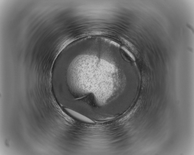 X0000096471178200802141651