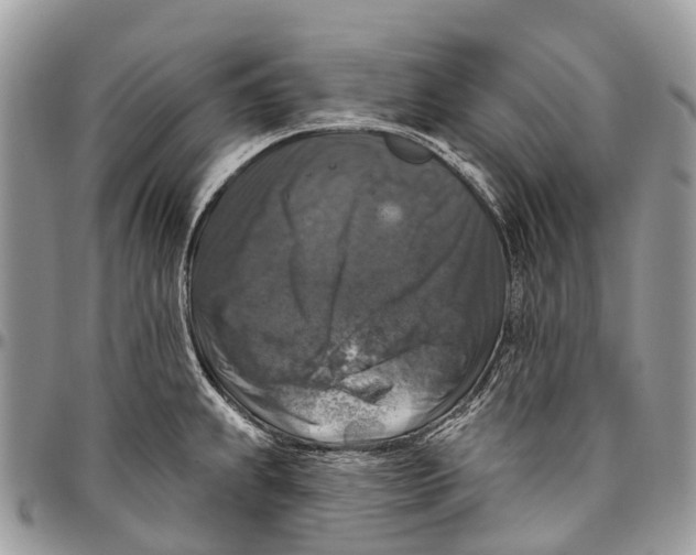 X0000096471239200802141650