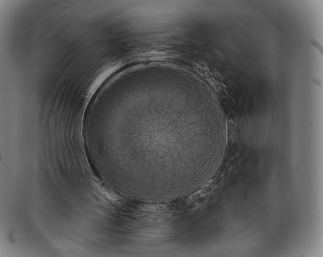 X0000096470147200802211159