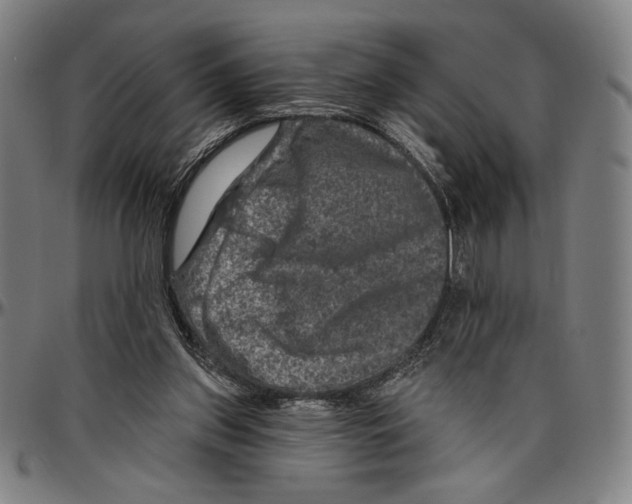 X0000096470157200802211159