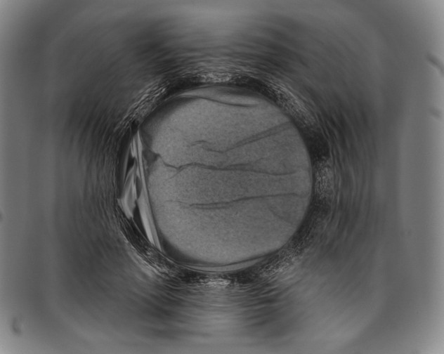 X0000096470598200802211152