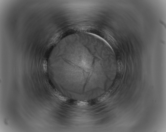 X0000096470718200802211150