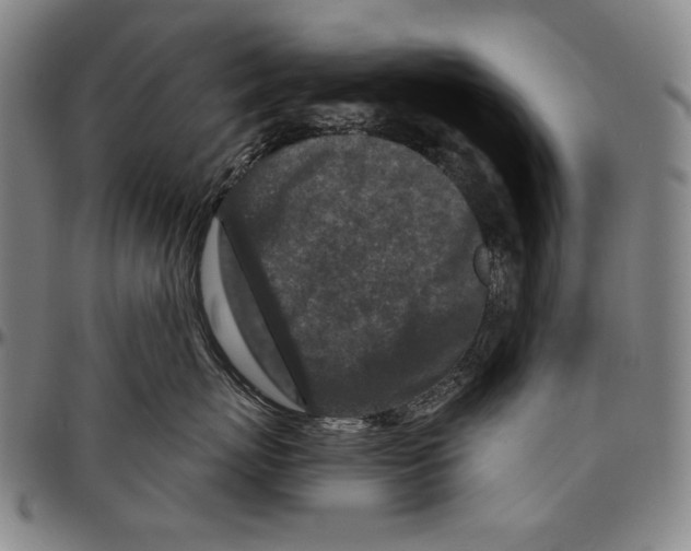 X0000096470767200802211150