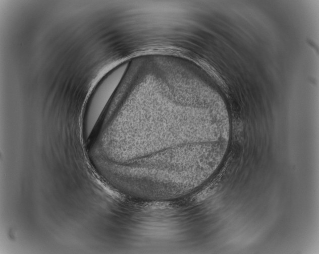 X0000096470846200802211148