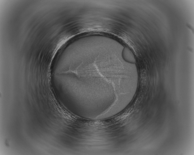 X0000096470879200802211148