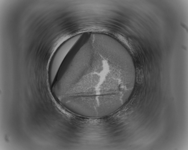 X0000096471087200802211144