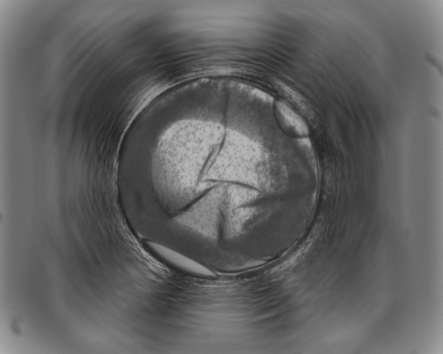 X0000096471178200802211143