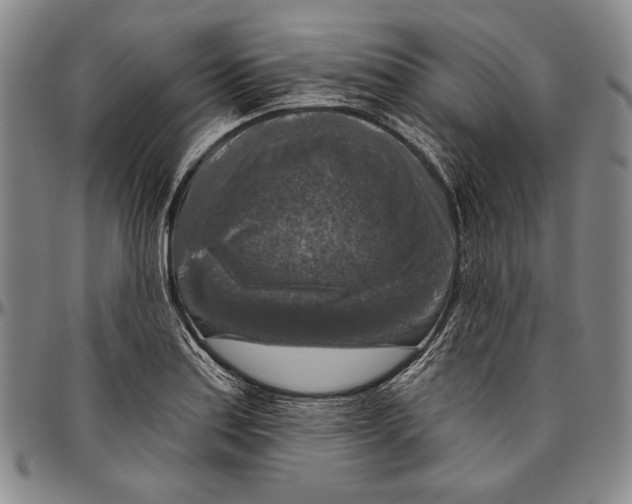 X0000096471179200802211143