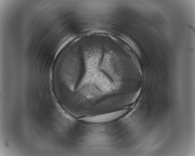 X0000096471198200802211142