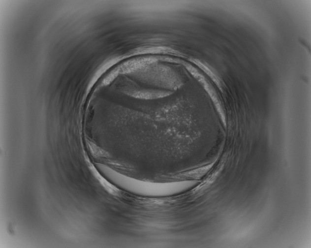 X0000096471438200802211139