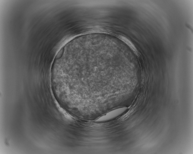 X0000096471439200802211139