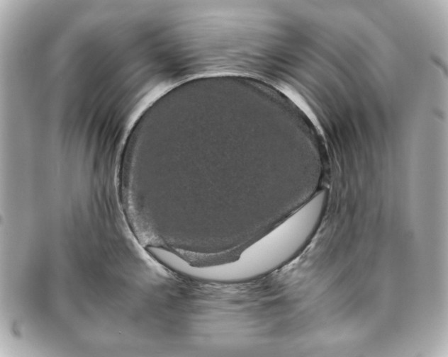 X0000096481197200802071912