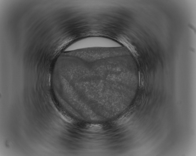 X0000096480157200802211222