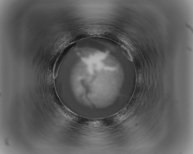 X0000096480411200802211219