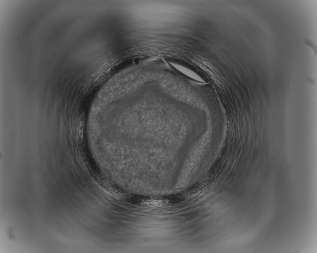 X0000096480499200802211217