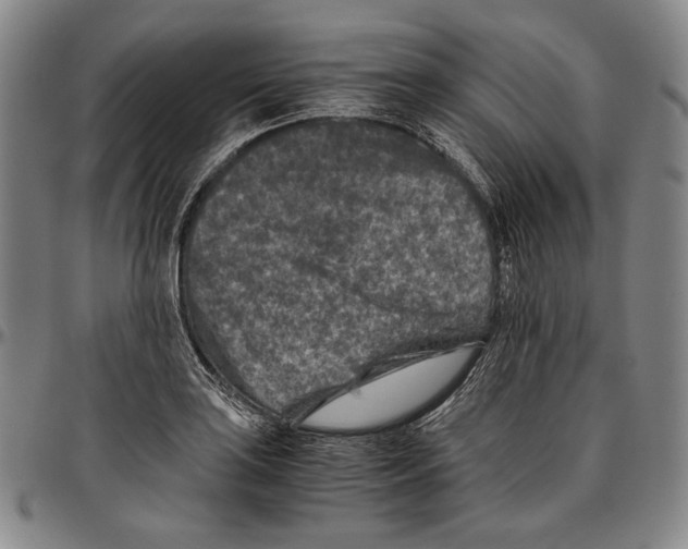 X0000096481035200802211209
