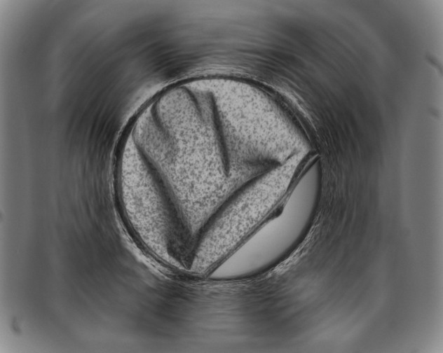 X0000096481038200802211209