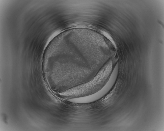 X0000096481146200802211208