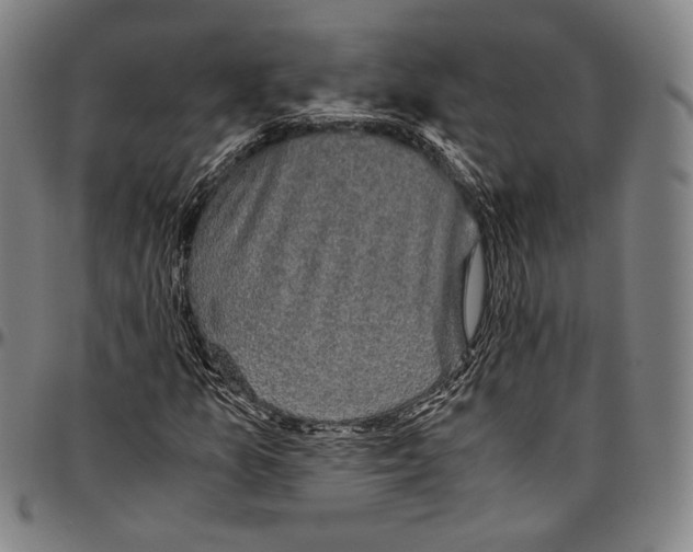 X0000096481157200802211207