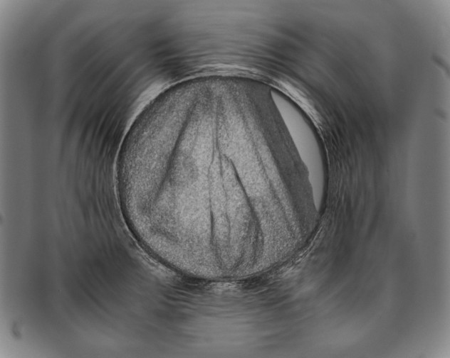 X0000096481283200802211206