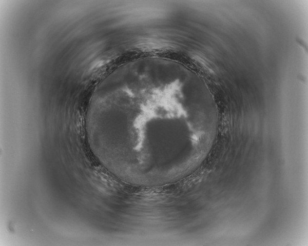 X0000096490917200802071939