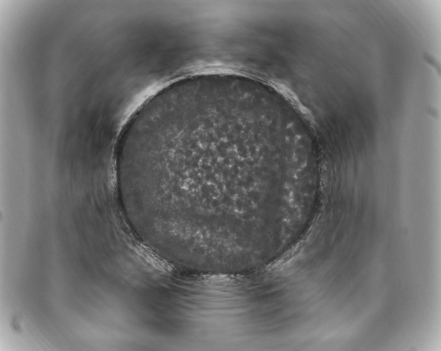 X0000096491167200802071936