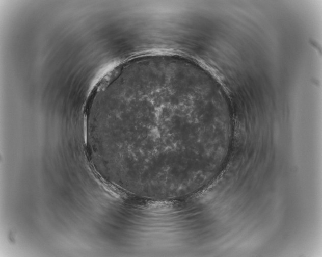 X0000096491171200802071936