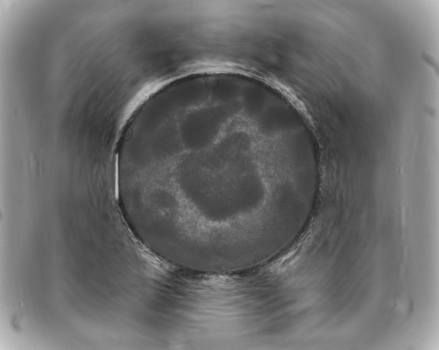 X0000096491175200802071936